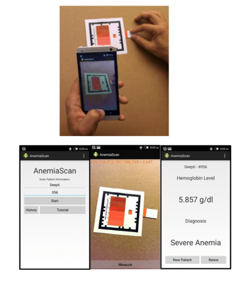 top photo: a person's hand taking a picture of test result using phone. Bottom photo: screenshot of anemia scan on mhealth tool